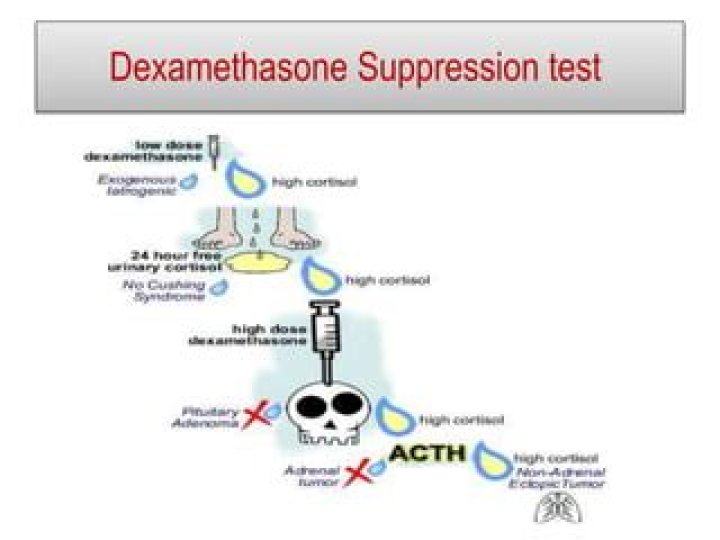 How does dexamethasone reduce cerebral edema?