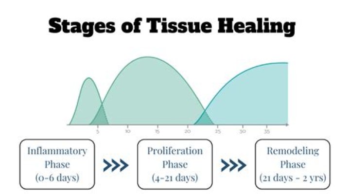 What are the 3 stages of tissue repair?