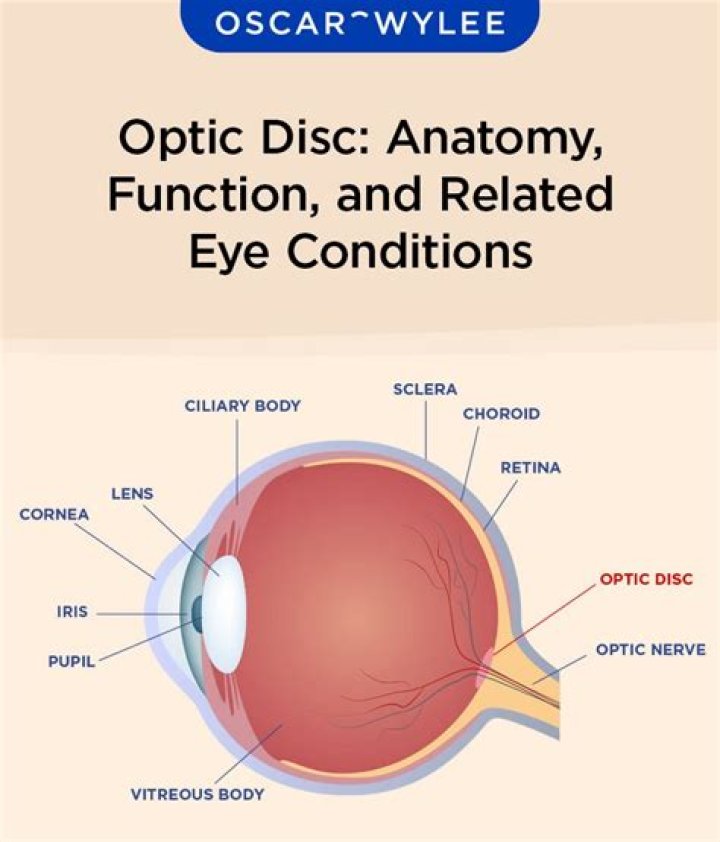 What is the optic disc commonly called?