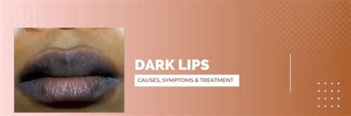 What medical condition causes dark lips?